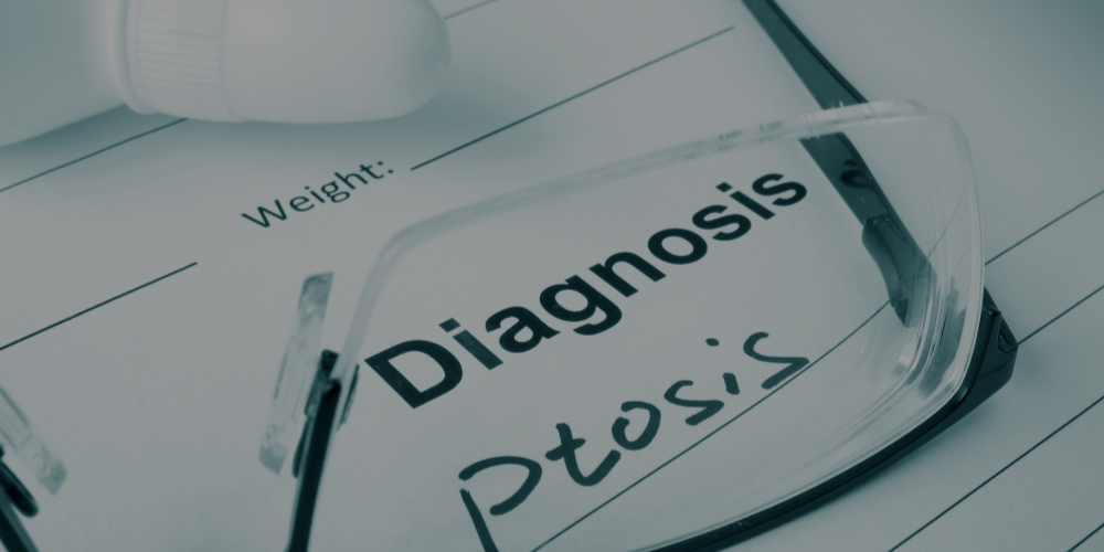 What is Ptosis?