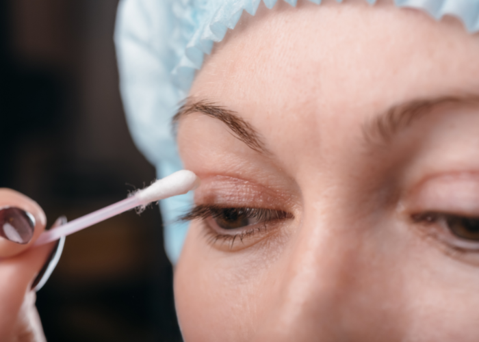 What Is Eyelid Drooping?