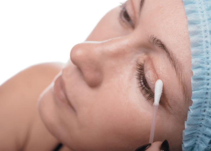 What Is Blepharoplasty?
